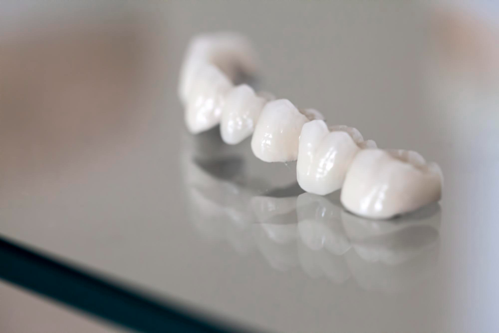 Porcelain Crowns in Louisville